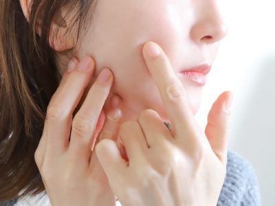 顔の白斑は治る？「顔だけ」「広がる」不安に答える原因と早期診断の重要性